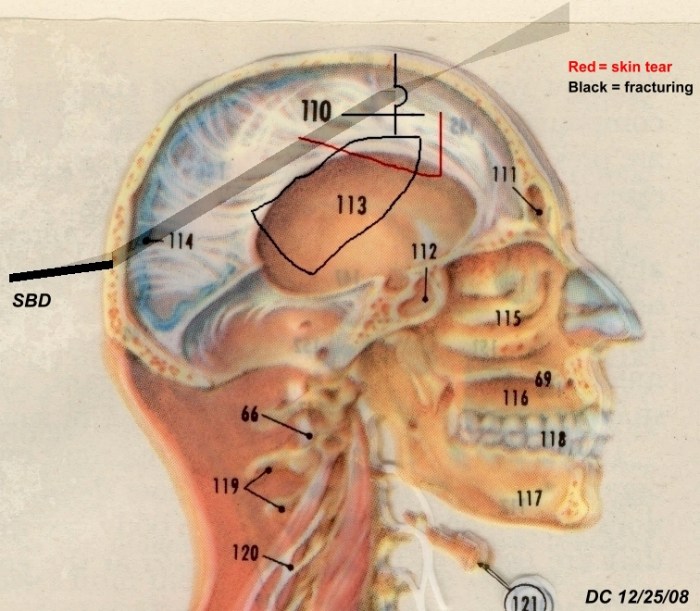 Nova cold case jfk assassination answers